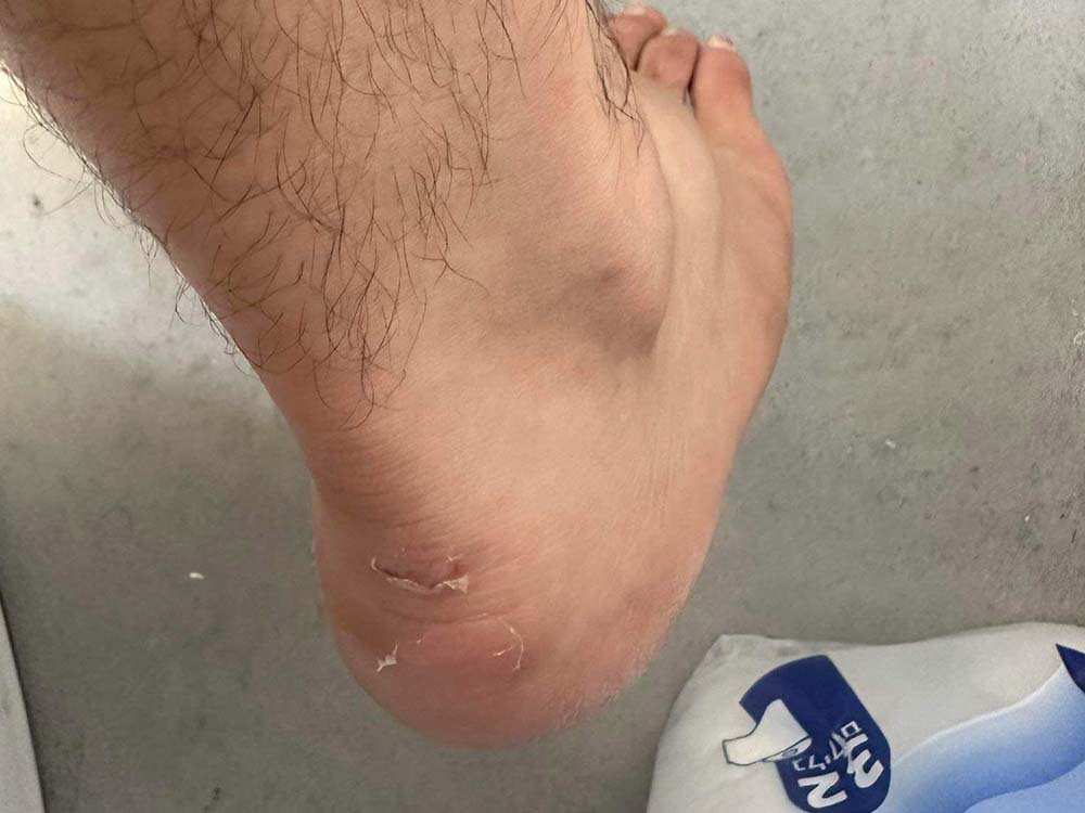 foot